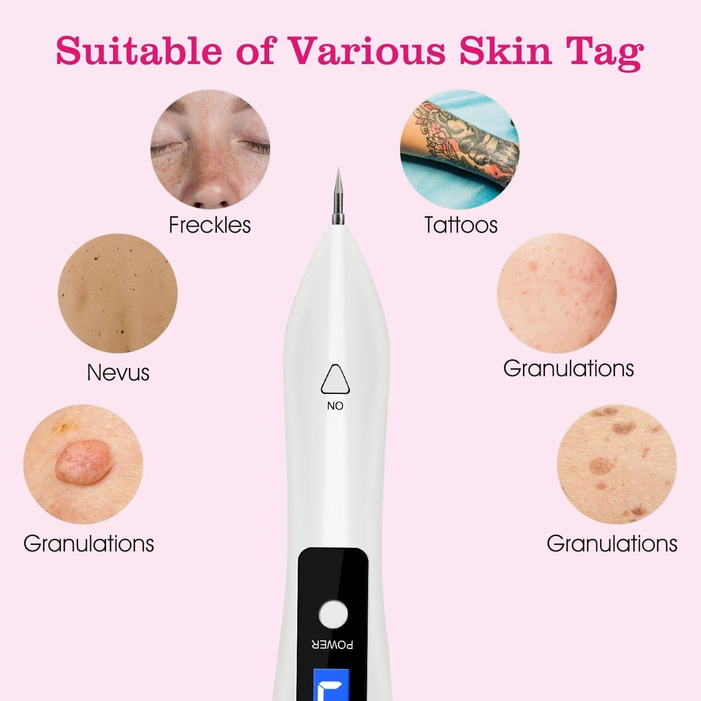 Skin Tag Repair Kit Portable Beauty Equipment Multi-Level with Home Usage USB Charging LCD Level Adjustable 6 Replaceable Needles - Clothes For Her Online Store